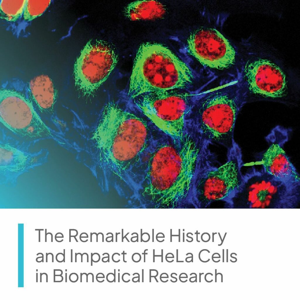 The_Remarkable_History_and_Impact_of_HeLa_Cells_in_Biomedical_Research