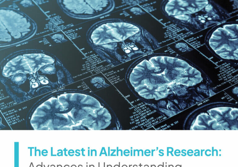 Fotos de escáneres cerebrales con el título del artículo escrito en la parte inferior de la imagen.