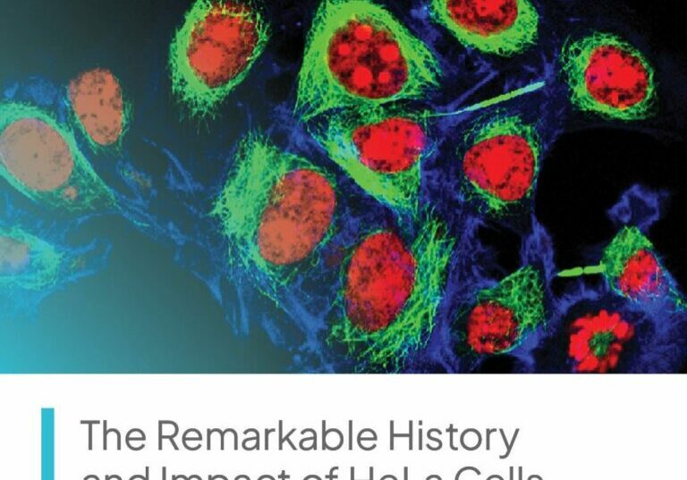 La_notable_historia_y_el_impacto_de_las_células_HeLa_en_la_investigación_biomédica